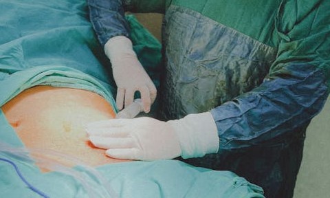 Doç. Dr. Erinç CAN Kalp ve Damar Hastalıkları Uzmanı