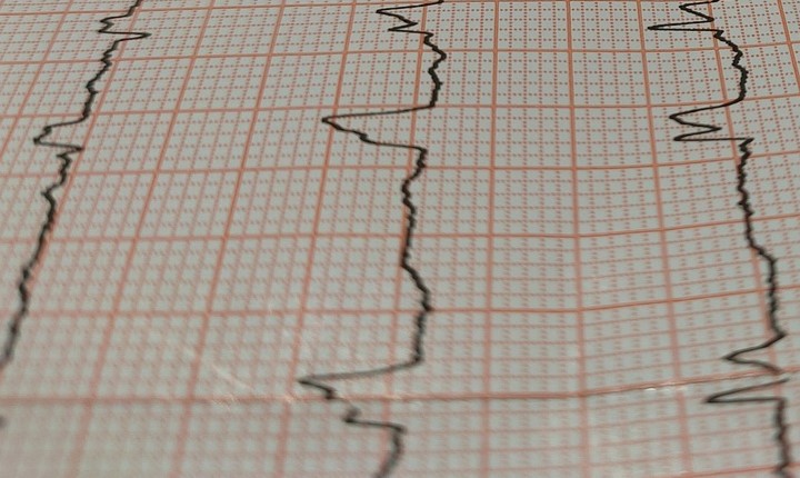 Doç. Dr. Erinç CAN Kalp ve Damar Hastalıkları Uzmanı