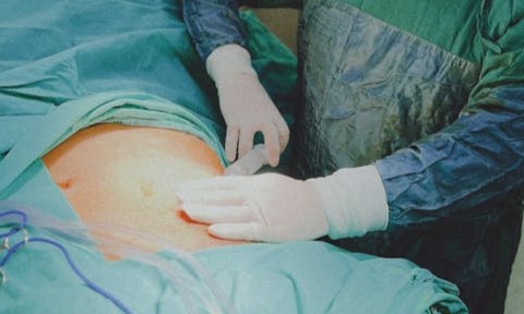 Doç. Dr. Erinç CAN Kalp ve Damar Hastalıkları Uzmanı